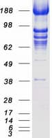 Human ERIC-1 / TACC3 Protein (Recombinant Myc-DDK (Flag))