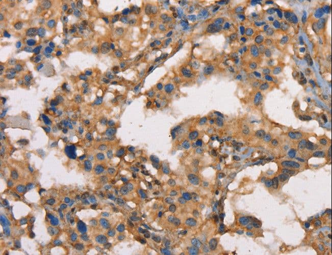 HK3 / Hexokinase 3 Antibody