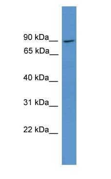 NCKIPSD / AF3P21 Antibody (aa471-520)