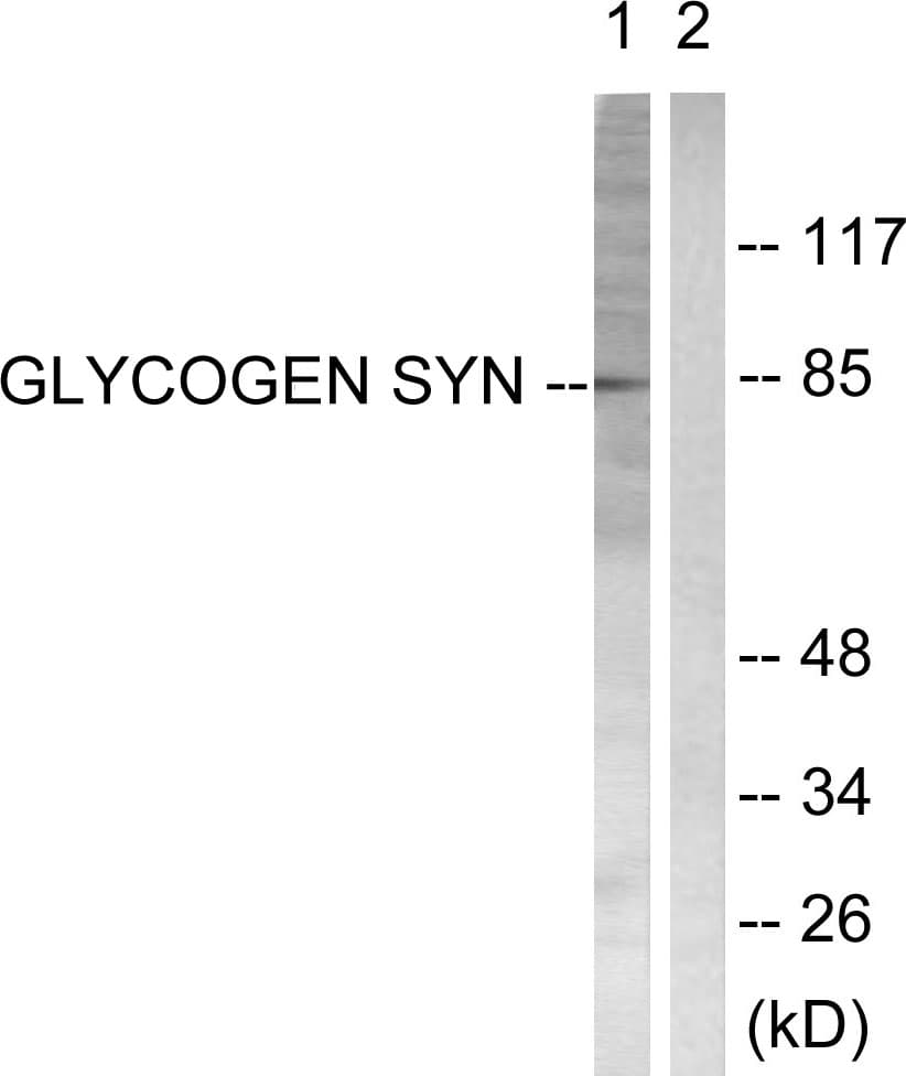 GYS1 / Glycogen Synthase Antibody (aa621-670)