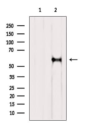 Polyclonal Rabbit anti-Human RIC8A Antibody (WB)