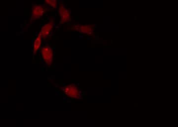 Polyclonal Rabbit anti-Human RACGAP1 / MGCRACGAP Antibody (IHC, IF, WB)