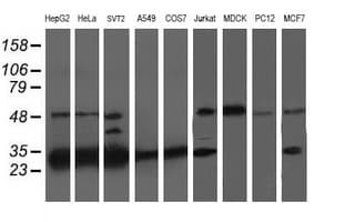 PSMB7 Antibody (clone OTI1E1)
