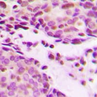 Histone H2B Antibody (Acetyl-Lys12)