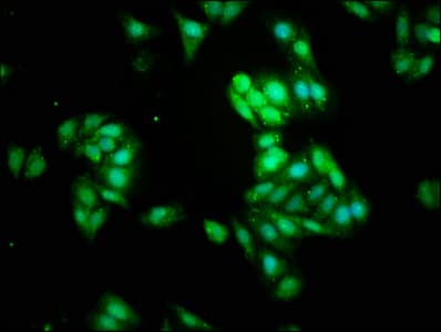 Polyclonal Rabbit anti-Human NOL3 / ARC Antibody (aa1-208, WB)