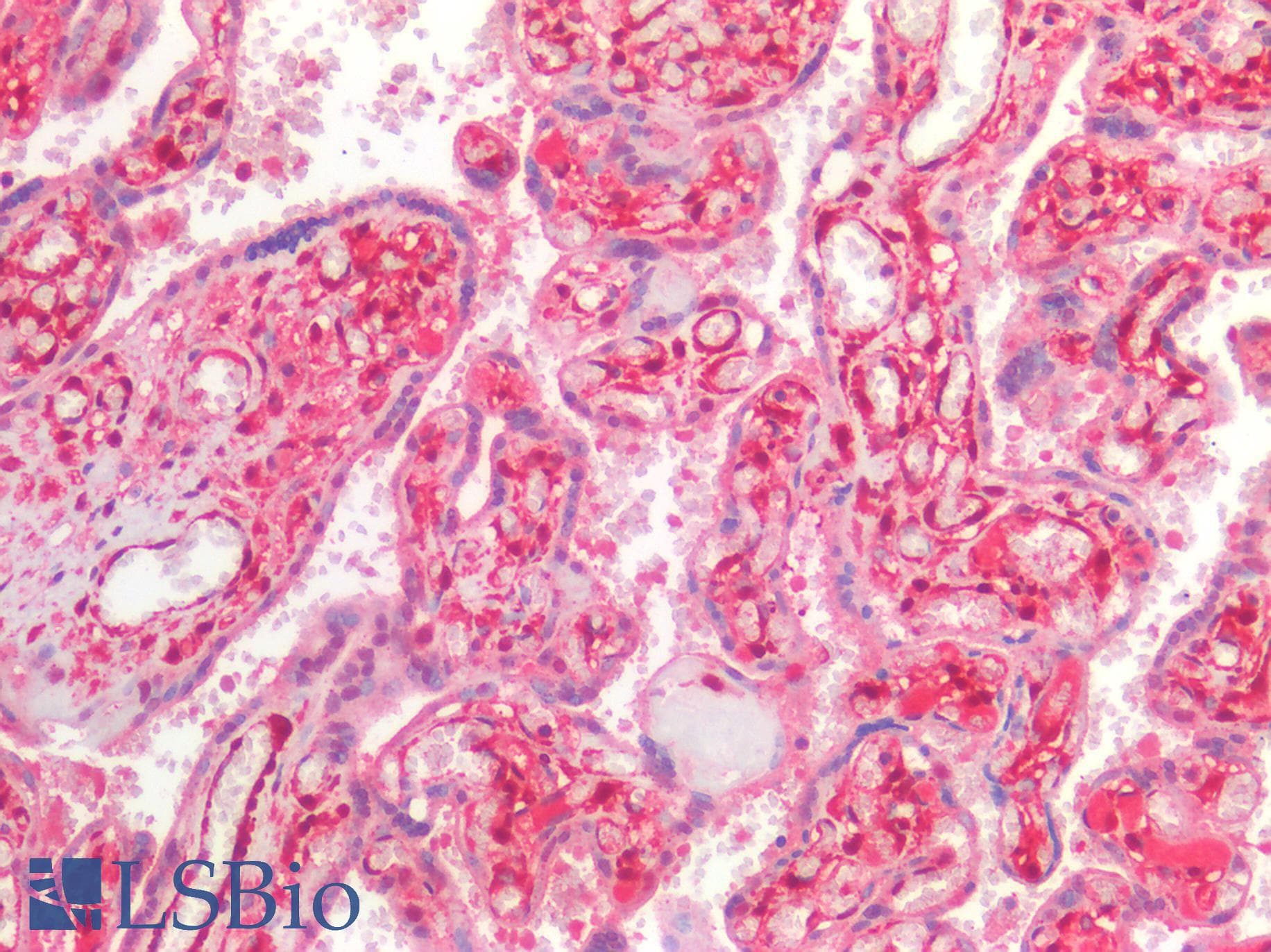 IHC-plus™ LGALS1 / Galectin 1 Antibody (aa2-135)