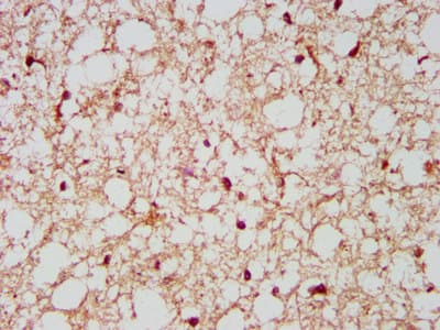 Neurochondrin Antibody