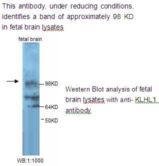 KLHL1 Antibody