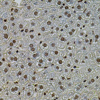 CREBBP / CREB Binding Protein Antibody