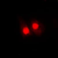 FANCA Antibody (phospho-Ser1149)