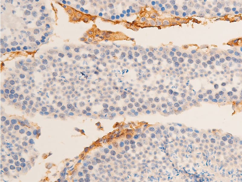 HSPB6 / HSP20 Antibody (phospho-Ser16)