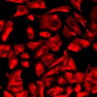 AGPAT2 Antibody