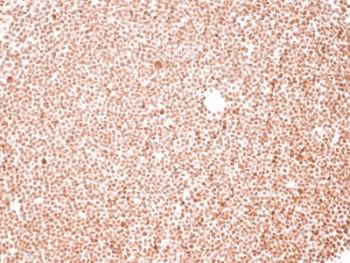 Nuclear Membrane Marker NM97 Antibody (clone NM95)