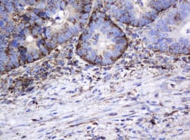 GLB1 / Beta-Galactosidase Antibody (clone OTI1C9)