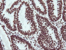 NONO / P54NRB Antibody (clone OTI3F8)