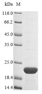 Mouse PHB / Prohibitin Protein (Recombinant 10His, N-terminus)