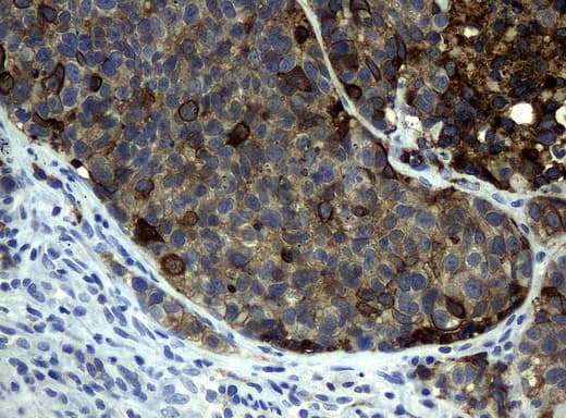 KRT19 / CK19 / Cytokeratin 19 Antibody (aa240-390, clone UMAB3, Carrier-free)