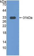 COIL / Coilin Antibody (aa319-538)