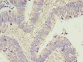 CDK5 Antibody (aa1-292)