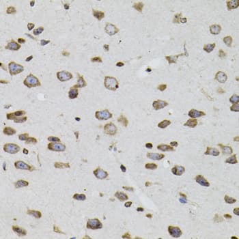 SOCS1 Antibody