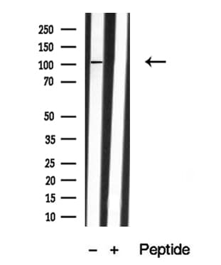 EPHB1 / EPH Receptor B1 Antibody