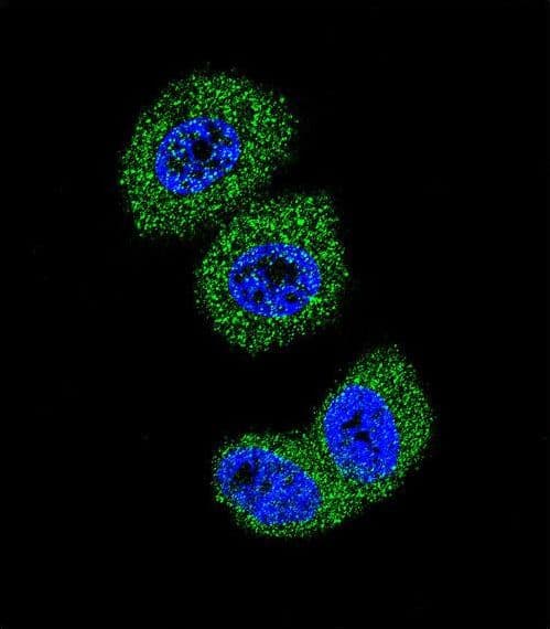 FOXO3 / FOXO3A Antibody (aa224-253)