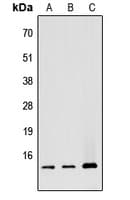 Polyclonal Rabbit anti-Human ATP5G1 / ATP5G Antibody (Internal, IHC, WB)