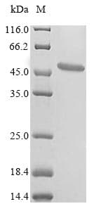 Lamprey MT-ND1 Protein (Recombinant 10His-SUMO, N-terminus)