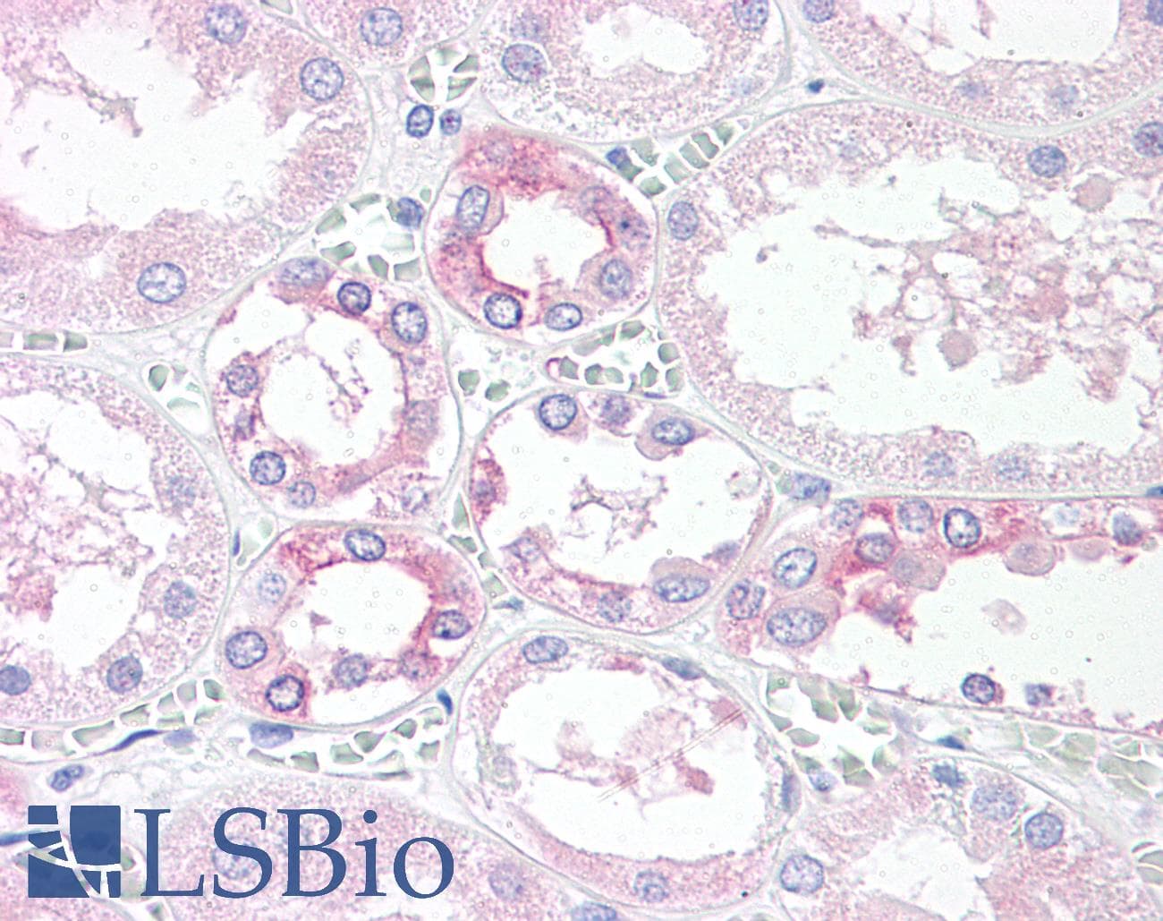 IHC-plus™ Polyclonal Rabbit anti-Human TM9SF4 Antibody (Internal, IHC)