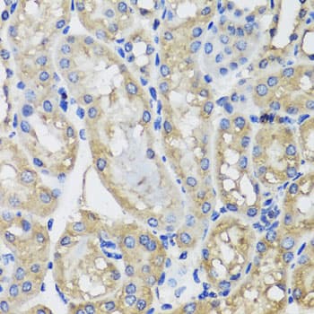 Polyclonal Rabbit anti-Human MRPS22 Antibody (IHC, WB)