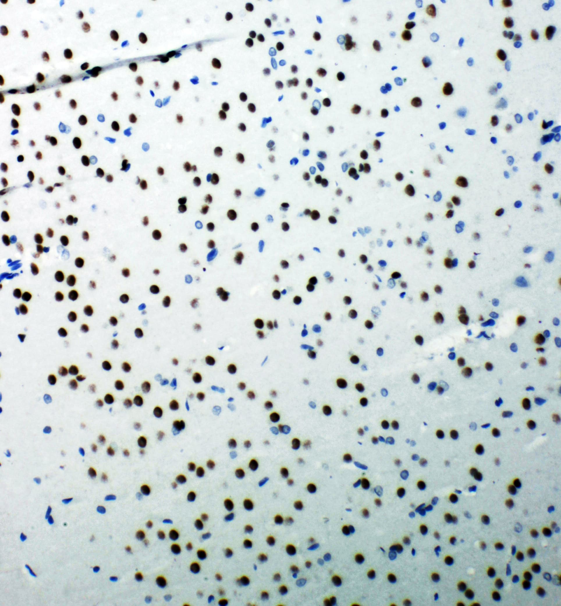 TP53BP1 / 53BP1 Antibody (aa1955-1972)