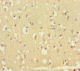 Polyclonal Rabbit anti-Human GATA6 Antibody (IHC)