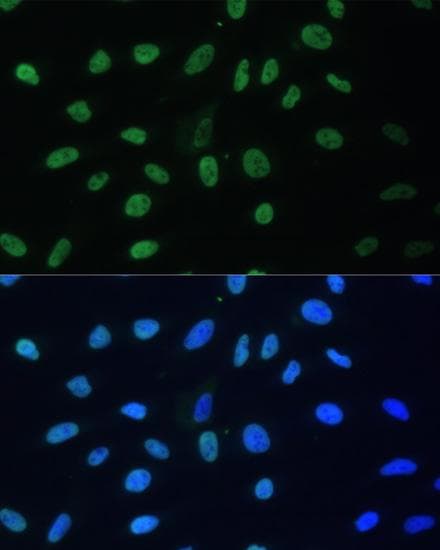 HNRNPD / AUF1 Antibody