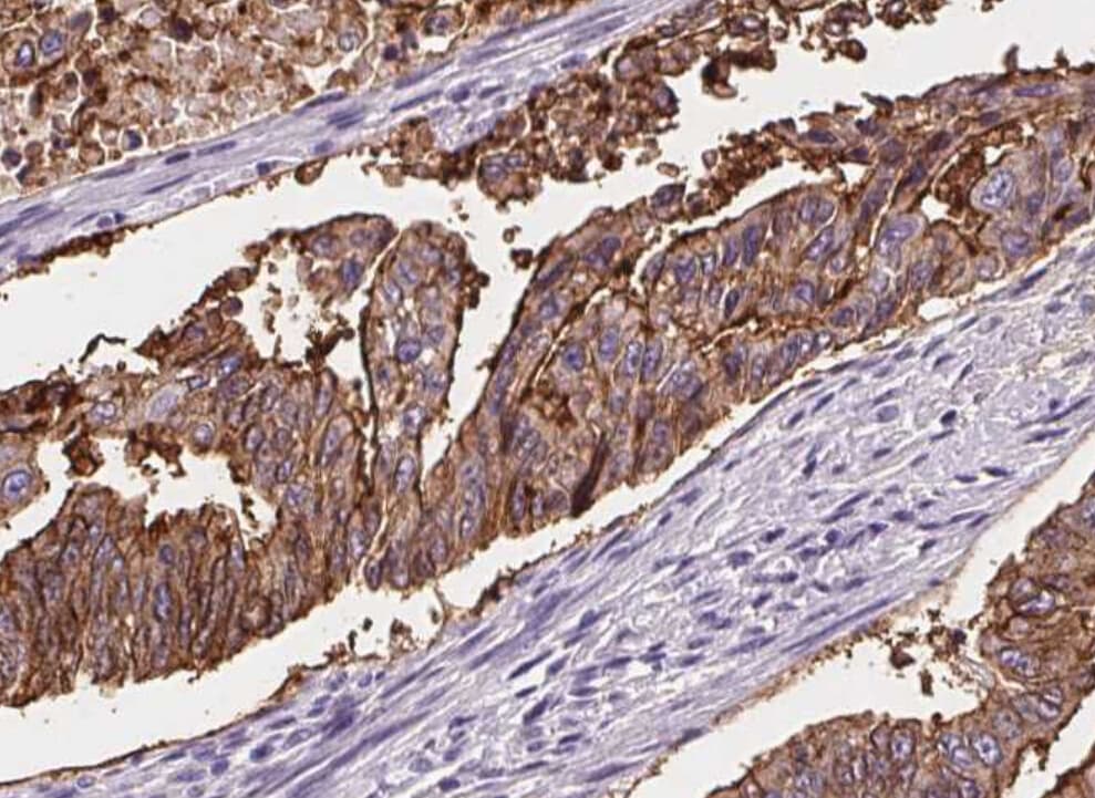 AQP5 / Aquaporin 5 Antibody