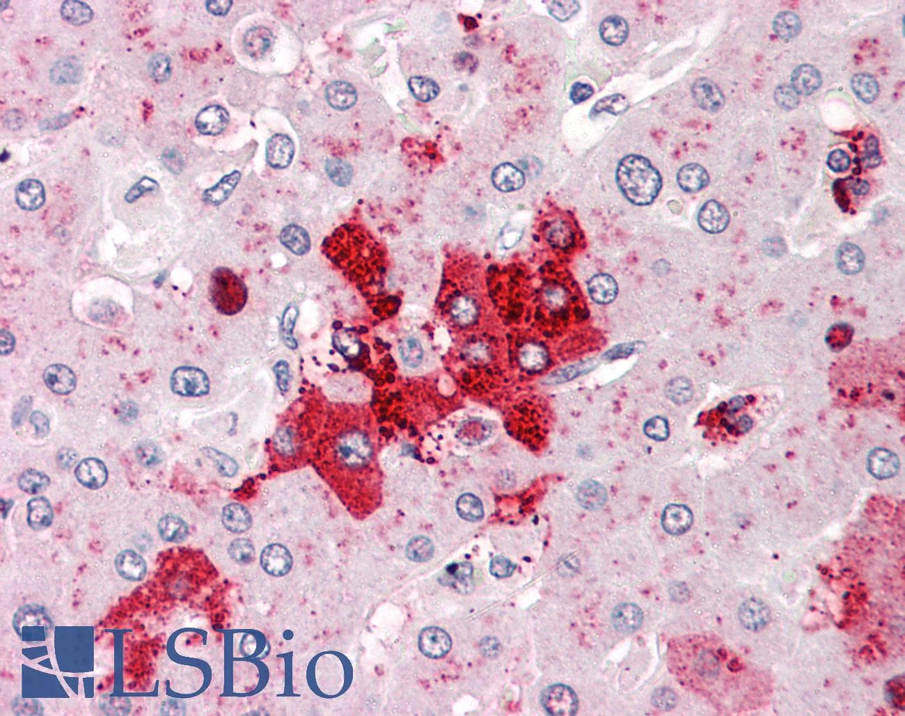 IHC-plus™ OLFM4 / Olfactomedin 4 Antibody (Internal)
