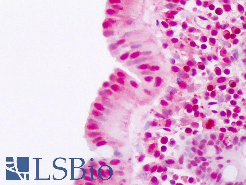IHC-plus™ Ubiquitin Antibody (clone 6C11-B3)