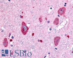 PathPlus™ GABBR1 / GABA B Receptor 1 Antibody (N-Terminus)