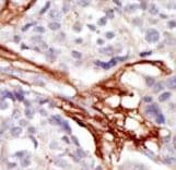 YES1 / c-Yes Antibody (aa1-30)