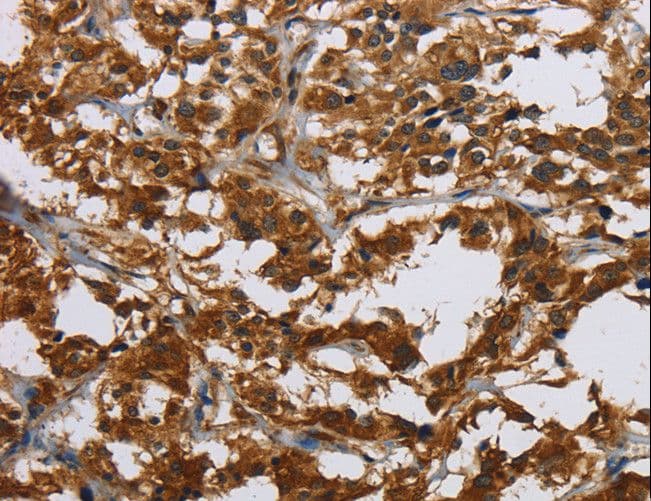 Polyclonal Rabbit anti-Human CLDN2 / Claudin 2 Antibody (IHC)