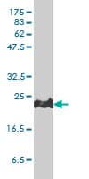 PRDX1 / Peroxiredoxin 1 Antibody (clone 4B11-D10)