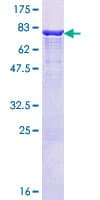 Human IFT57 / HIPPI Protein (Recombinant GST)