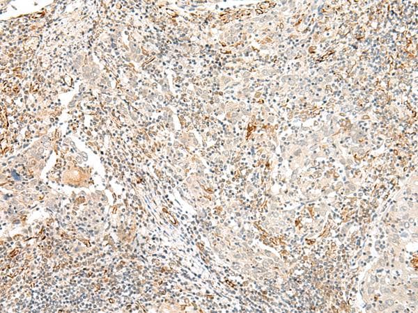 Polyclonal Rabbit anti-Human TAAR2 / GPR58 Antibody (IHC, WB)
