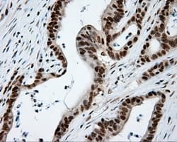 TLDC1 / KIAA1609 Antibody (clone OTI12B1)