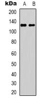 UBE3B Antibody (Internal)