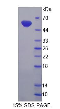 Rat UGT2B7 Protein (Recombinant)