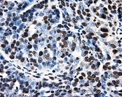 PSMC3 Antibody (clone OTI9F3, Carrier-free)