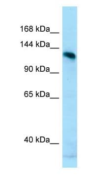 AMPD2 Antibody (aa244-293)