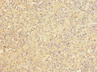 COPB2 / Beta-COP Antibody