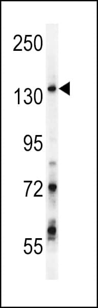 Polyclonal Rabbit anti-Human GPRASP1 / GASP-1 Antibody (aa1149-1176, IHC, WB)