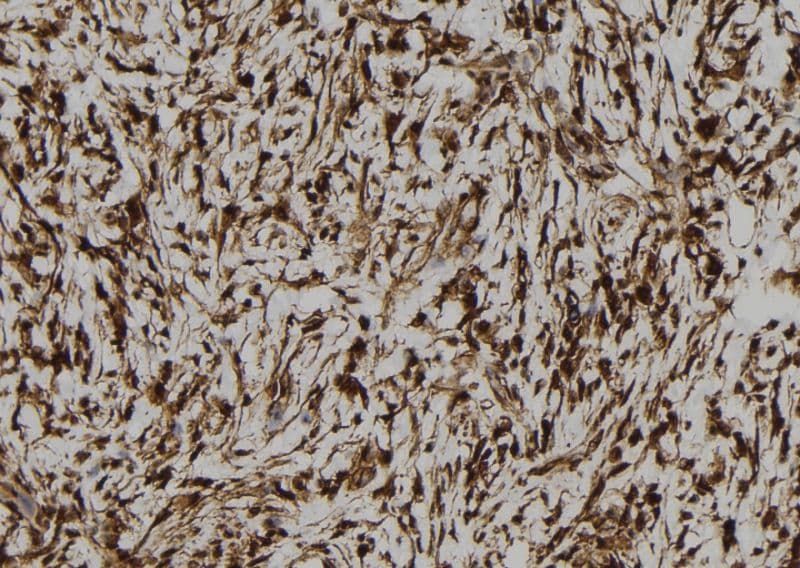 OASIS / CREB3L1 Antibody